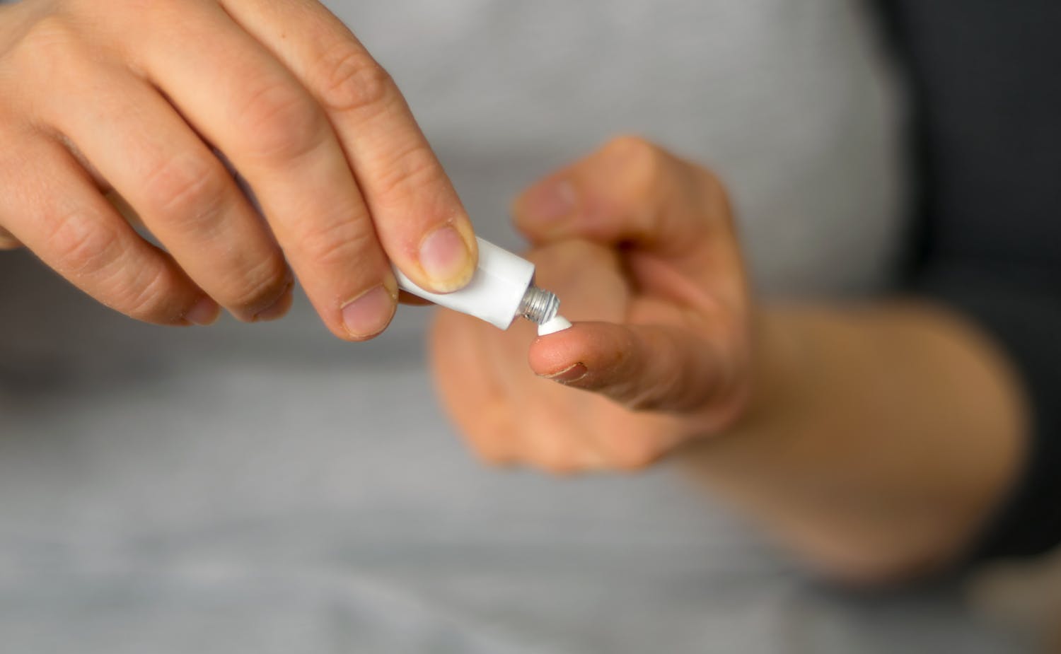 Furoncle : quels traitements ? Peut-on se soigner soi-même ?