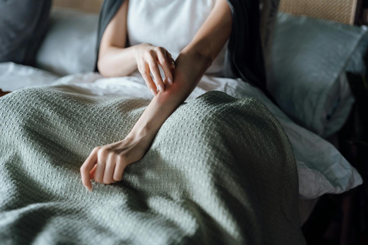 Que faire en cas d'allergie cutanée ?