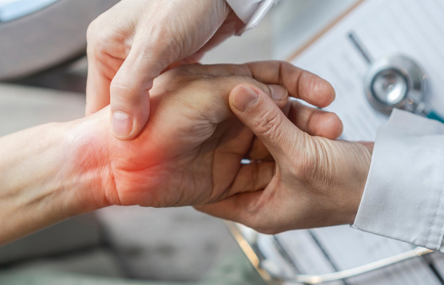 Tout savoir sur le lunatum : un petit os essentiel du poignet