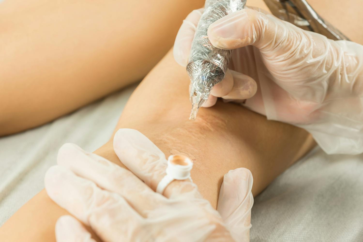 Tatouer ses vergetures pour les masquer : bonne ou mauvaise idée ?