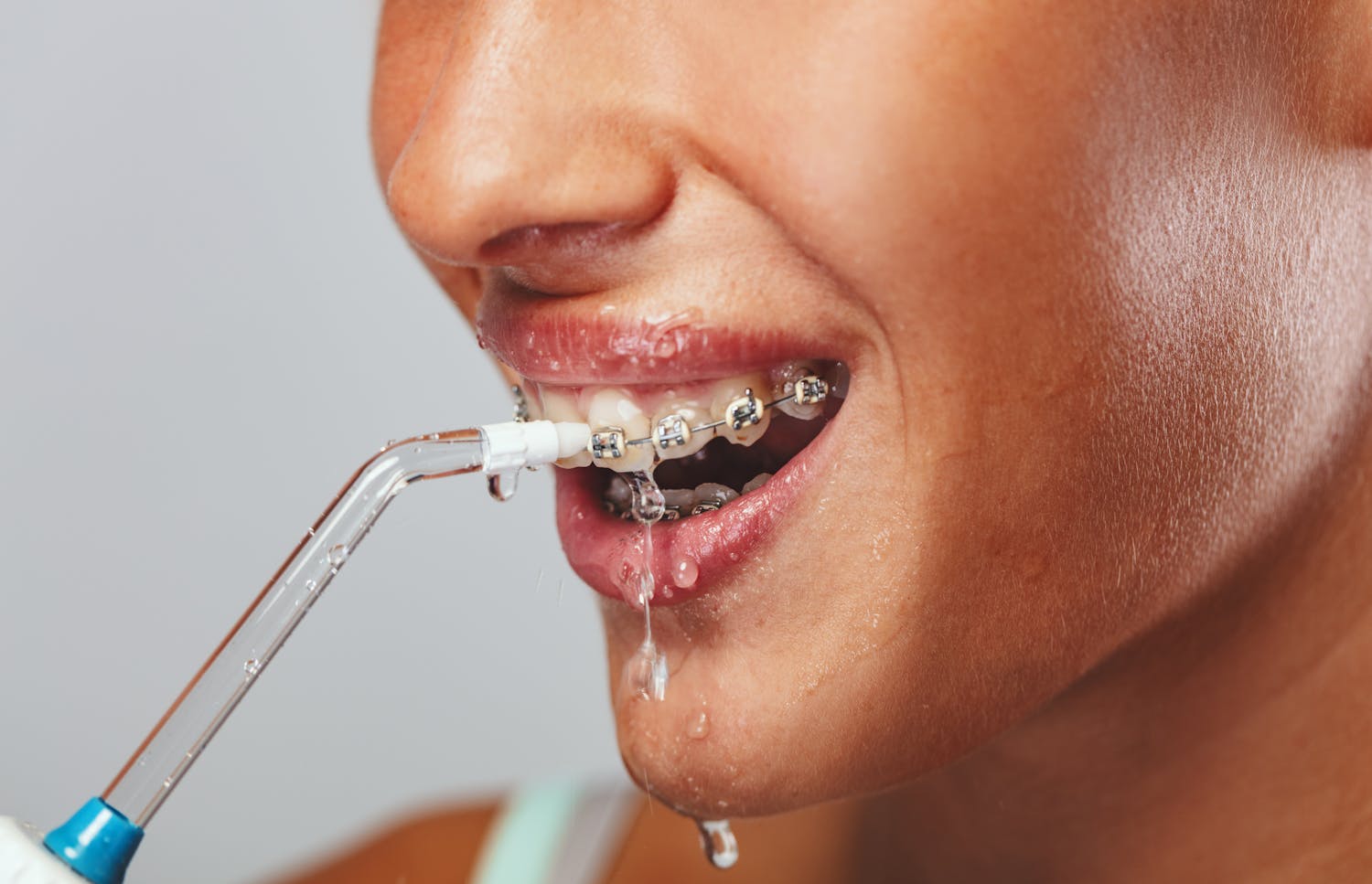 Hygiène des dents : un hydropulseur est-il vraiment utile ?