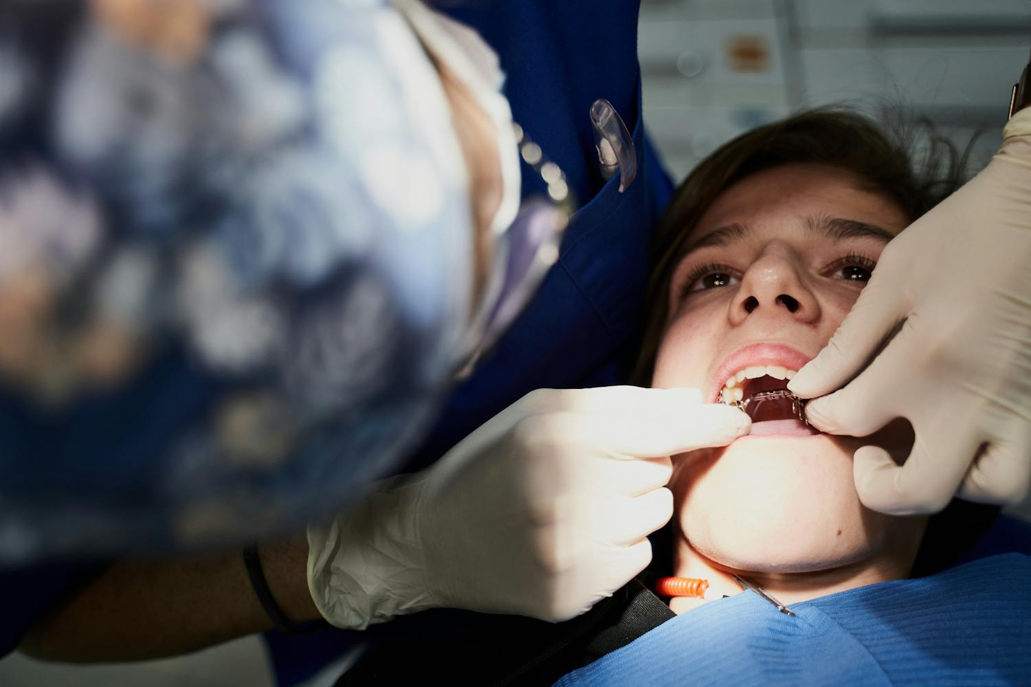 Bagues, gouttières, chirurgie… Comment aligner ses dents ?